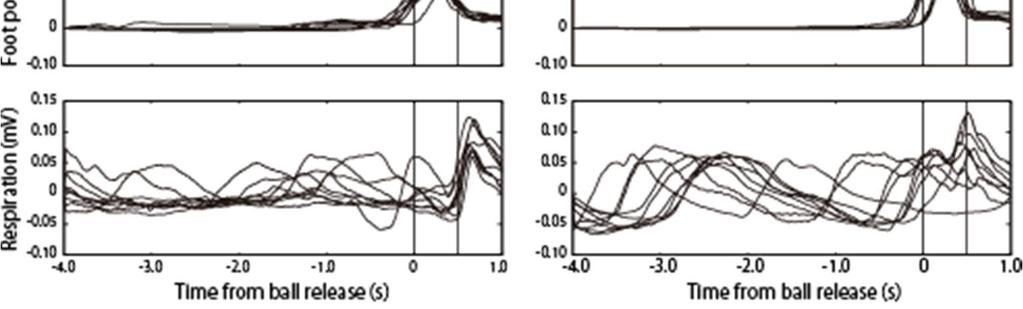 This figure shows the head and foot movements and the respiratory waveforms for each of 10 trials that involved randomly presenting fast balls that were strikes.