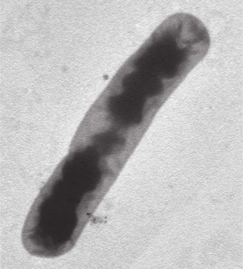 Figure 2: Corynebacterium: increase 12,000 nm. Transmission electron microscope JEM-1011. animals of the experimental group as compared to the control one 9.5%.