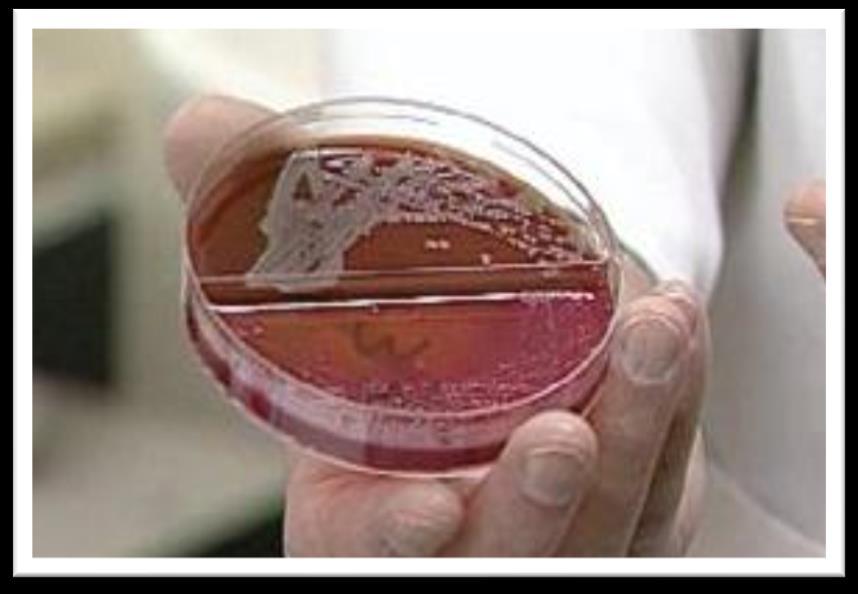 Microbiological Testing In the event of any health problems Following