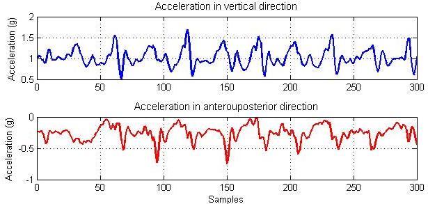 Figure 6.6 The patterns of accelerations in the vertical and antero-posterior directions easured fro a healthy subject Figure 6.7 and Figure 6.