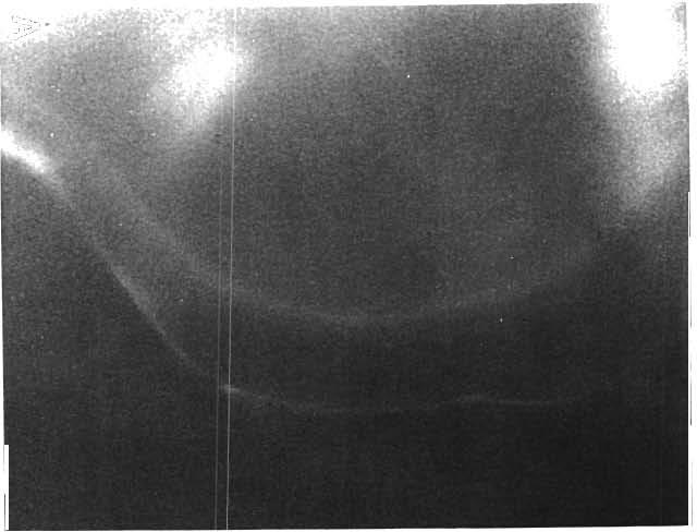 Mar. Ecol. Prog. Ser. 36: 65-79, 1987 Fig. 3. Parika scaber. (A) Sagitta viewed under ultra-violet light. A tetralysal marker can be seen as a fluorescent line.