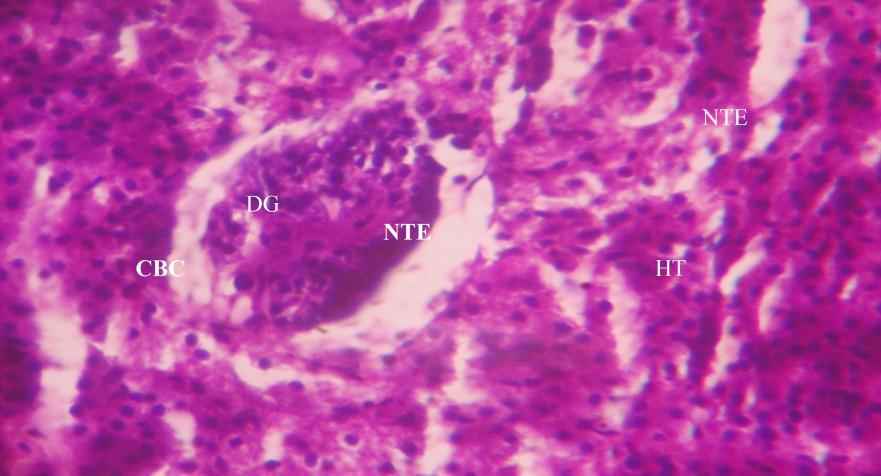 HT=Hypertrophy, CBC=Contraction Bowman s capsule NTE DG NTE HT CBC Liver Histology the liver from control group showed normal homogenous mass hepatocytes with centrally located nuclei and granular