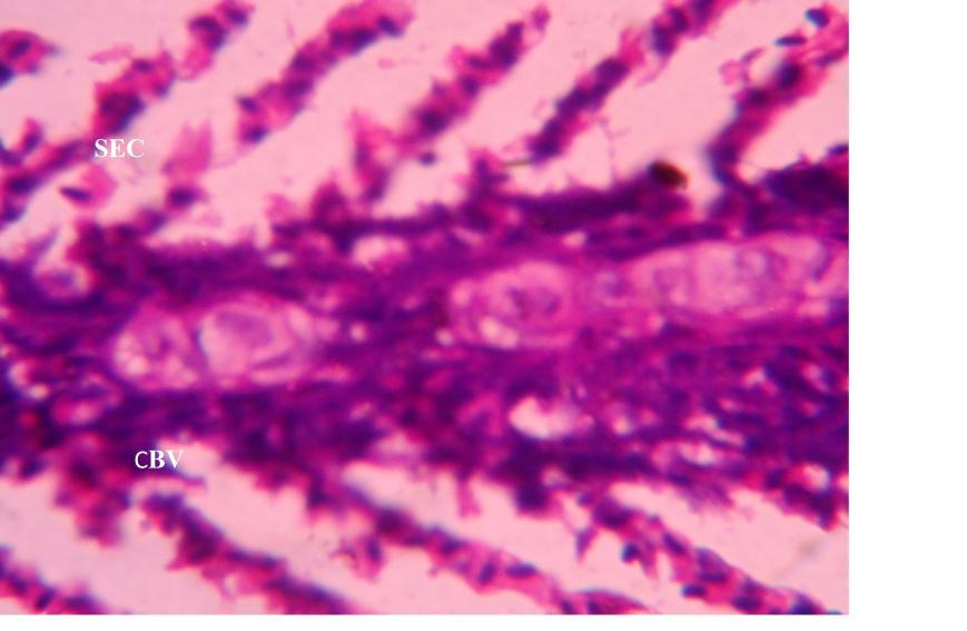 epithelial lining, SEC=Swelling epithelial cells, N=