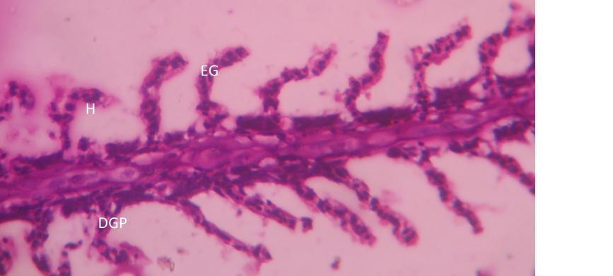 cells, EGL=Erosion gill lamellae, NRE= Necrosis in renal
