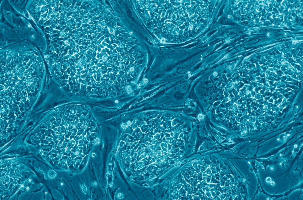 Stem Cells Unspecialized cells capable of renewing themselves through cell division.