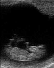 embryonic vesicle A further scan around 28 days to check the normal development by identification of the foal s heartbeat is advised.