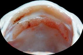 ) 6 pelvic-fin rays; ) caudal fin yellowish; ) a crescent patch of tooth (divided into 2 patches in photo specimen) behind tooth band of upper jaw. To 100 cm SL. Southern hina to Mekong basin.