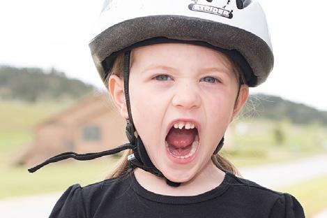 If the helmet fits properly, the skin on the forehead will move as the helmet moves.