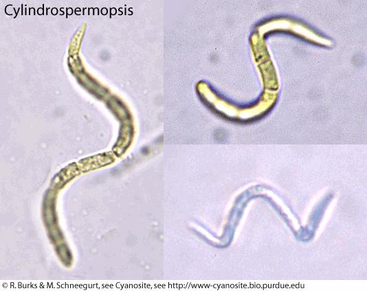 Cylindrospermopsis invasive