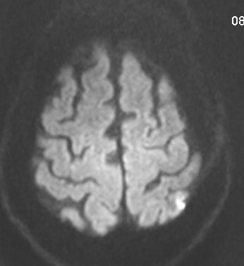 brain lesions M. Urbanczyk, P.