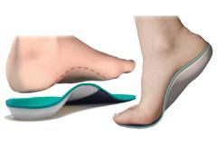 Primary aim of treatment Provide pain relief Often attempted using shoe inserts.
