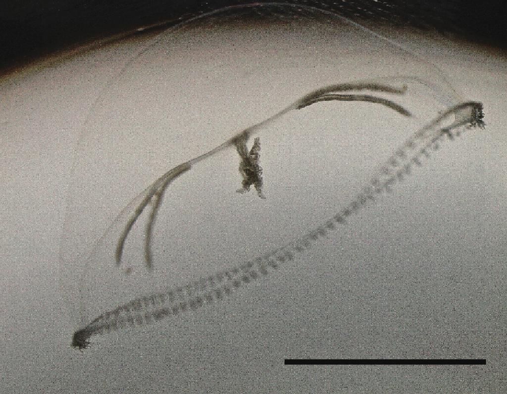 from mura Bay, Nagasaki Prefecture, Kyushu, Japan. 11.2 mm in diameter. (Holotype). Scale bar = 5 mm. Fig. 3. Oral lips of Malagazzia hirsutissima n. sp.