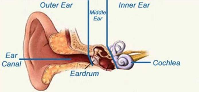 Result of pressure imbalance in gas-filled spaces in the body Can affect any gas-filled space in the body Middle Ear Squeeze Tympanic