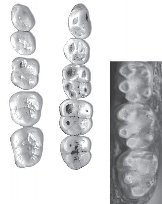 82 Chapter 3 FIGURE 3.2. Teeth with different wear patterns.