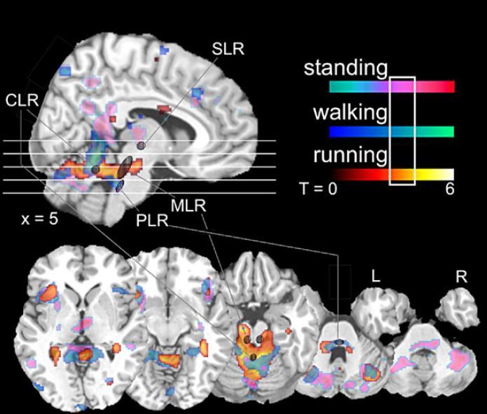 Evidence for supraspinal locomotor regions in humans In humans, the fmri activity patterns during the imagination of standing,