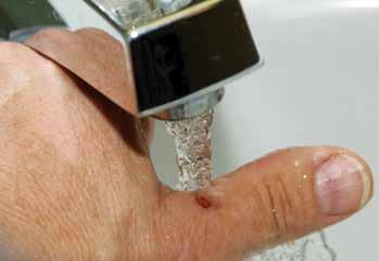 Minor Wounds and Injuries. Cuts and Scrapes (Abrasions) Cuts may be caused by knives, razors, or broken glass.