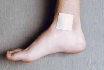 Minor Wounds and Injuries. Blisters on the Hand and Foot Blisters are pockets of fluid that form when the skin is aggravated by friction.