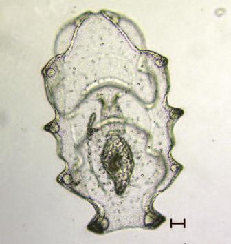 The occurrence of protozoan parasites during sea cucumber larviculture is a common problem that