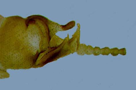 14 15 Figs. 14 15. Zelandobius patricki. 14. Male genitalia, lateral, 15.